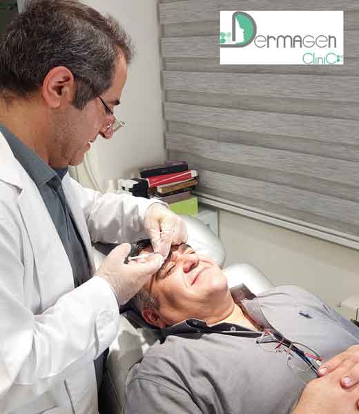 تزریق بوتاکس